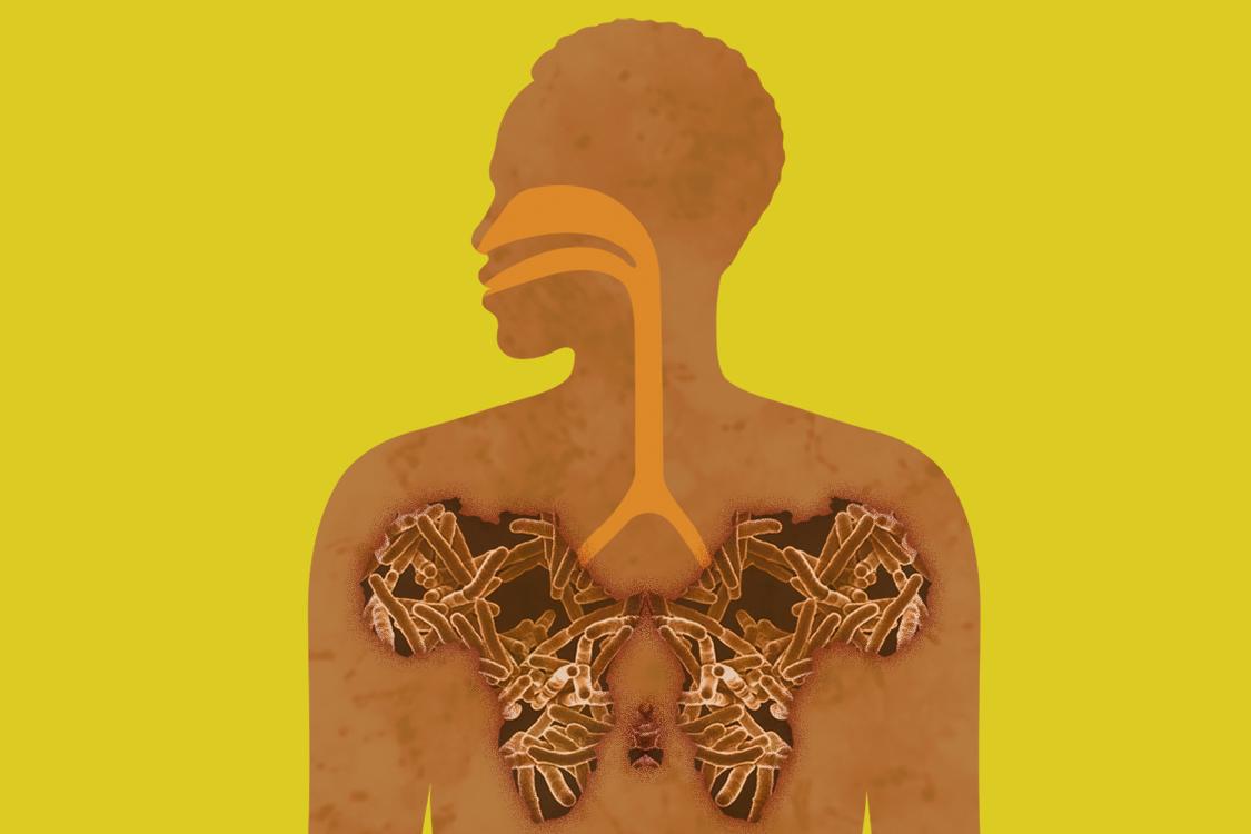 Silhouette of person with lungs shaped like the continent of Africa filled with TB bacteria